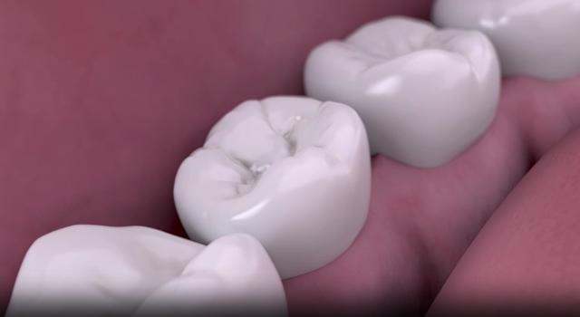 Swiss Startup - Credentis Product Image