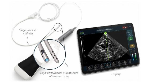 Swiss Startup - Rhovica Neuroimaging Product Image