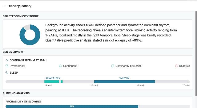Swiss Startup - dEEGtal Insights Product Image